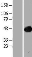 ARFGAP1 Protein - Western validation with an anti-DDK antibody * L: Control HEK293 lysate R: Over-expression lysate