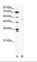 ARFGAP2 / ZNF289 Antibody - A: Marker, B: HepG2 Cell Lysate.  This image was taken for the unconjugated form of this product. Other forms have not been tested.