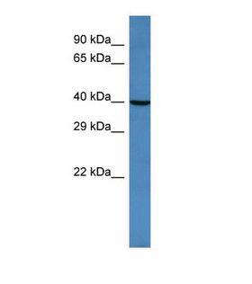 ARFGAP2 / ZNF289 Antibody - Western blot of Human HeLa. ARFGAP2 antibody dilution 1.0 ug/ml.  This image was taken for the unconjugated form of this product. Other forms have not been tested.