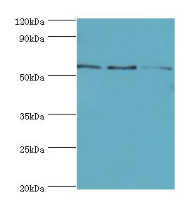 ARFGAP3 Antibody - Western blot. All lanes: ARFGAP3 antibody at 4 ug/ml. Lane 1: HepG2 whole cell lysate. Lane 2: Jurkat whole cell lysate. Lane 3: A549 whole cell lysate. Secondary antibody: Goat polyclonal to rabbit at 1:10000 dilution. Predicted band size: 57 kDa. Observed band size: 57 kDa.