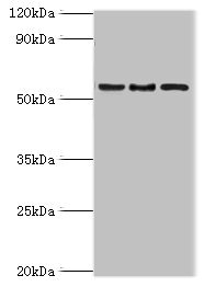 ARFGAP3 Antibody - Western blot All lanes: ARFGAP3 antibody at 4µg/ml Lane 1: HepG2 whole cell lysate Lane 2: Jurkat whole cell lysate Lane 3: A549 whole cell lysate Secondary Goat polyclonal to rabbit IgG at 1/10000 dilution Predicted band size: 57, 52 kDa Observed band size: 57 kDa