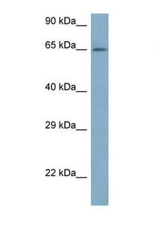 ARFGAP3 Antibody - ARFGAP3 antibody Western blot of 721_B Cell lysate. Antibody concentration 1 ug/ml.  This image was taken for the unconjugated form of this product. Other forms have not been tested.