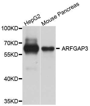 ARFGAP3 Antibody - Western blot analysis of extract of various cells.