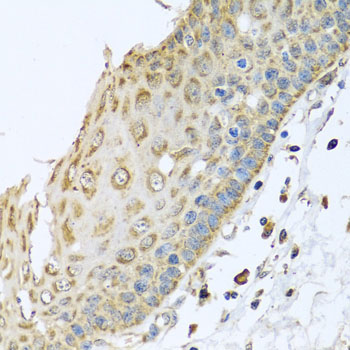 ARFGAP3 Antibody - Immunohistochemistry of paraffin-embedded human esophagus.