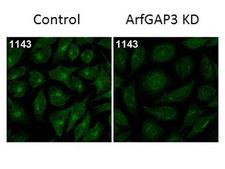 ARFGAP3 Antibody - Immunofluorescence Microscopy of Rabbit Anti-ArfGAP3 Antibody. Tissue: HeLa Whole Cell. Fixation: MeOH. Antigen retrieval: not required. Primary antibody: ArfGAP3 antibody at 1:100 for 1 h at RT. Secondary antibody: Fluorescein rabbit secondary antibody at 1:10,000 for 45 min at RT. Localization: ArfGAP3 is cytoplasmic. Staining: ArfGAP3 as green fluorescent signal.