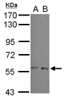 ARFGAP3 Antibody - Sample (30 ug of whole cell lysate) A: A549 B: HeLa 7.5% SDS PAGE ARFGAP3 antibody diluted at 1:1000