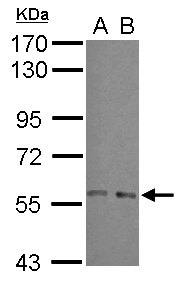 ARFGAP3 Antibody - Sample (30 ug of whole cell lysate) A: A549 B: HeLa 7.5% SDS PAGE ARFGAP3 antibody diluted at 1:1000