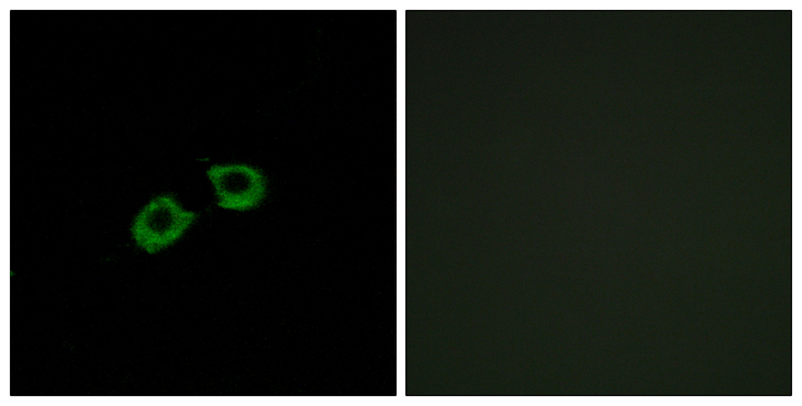 ARFGEF2 / BIG2 Antibody - Immunofluorescence analysis of A549 cells, using ARFGEF2 Antibody. The picture on the right is blocked with the synthesized peptide.