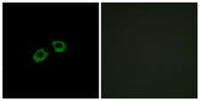 ARFGEF2 / BIG2 Antibody - Immunofluorescence analysis of A549 cells, using ARFGEF2 Antibody. The picture on the right is blocked with the synthesized peptide.