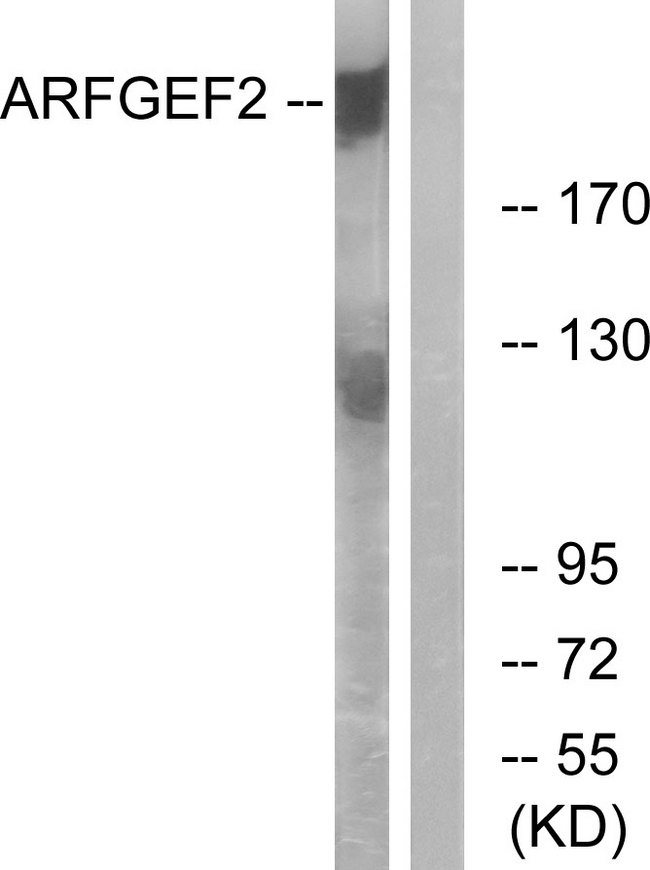 ARFGEF2 / BIG2 Antibody - Western blot analysis of lysates from A549 cells, using ARFGEF2 Antibody. The lane on the right is blocked with the synthesized peptide.