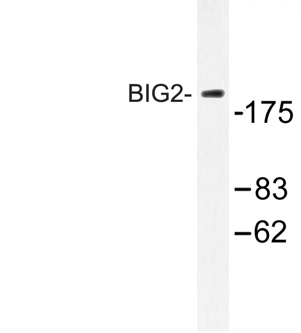 ARFGEF2 / BIG2 Antibody - Western blot of BIG2 (L1527) pAb in extracts from A549 cells.