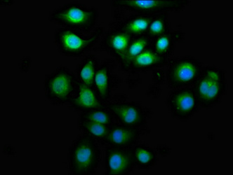 ARFGEF2 / BIG2 Antibody - Immunofluorescence staining of A549 cells at a dilution of 1:133, counter-stained with DAPI. The cells were fixed in 4% formaldehyde, permeabilized using 0.2% Triton X-100 and blocked in 10% normal Goat Serum. The cells were then incubated with the antibody overnight at 4°C.The secondary antibody was Alexa Fluor 488-congugated AffiniPure Goat Anti-Rabbit IgG (H+L) .