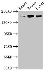 ARFGEF2 / BIG2 Antibody - Positive Western Blot detected in Rat heart tissue, Mouse brain tissue, Mouse liver tissue. All lanes: ARFGEF2 antibody at 3.2 µg/ml Secondary Goat polyclonal to rabbit IgG at 1/50000 dilution. Predicted band size: 203 KDa. Observed band size: 203 KDa