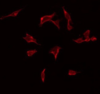 ARFGEF2 / BIG2 Antibody - Staining A549 cells by IF/ICC. The samples were fixed with PFA and permeabilized in 0.1% Triton X-100, then blocked in 10% serum for 45 min at 25°C. The primary antibody was diluted at 1:200 and incubated with the sample for 1 hour at 37°C. An Alexa Fluor 594 conjugated goat anti-rabbit IgG (H+L) Ab, diluted at 1/600, was used as the secondary antibody.