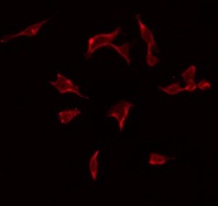 ARFGEF2 / BIG2 Antibody - Staining A549 cells by IF/ICC. The samples were fixed with PFA and permeabilized in 0.1% Triton X-100, then blocked in 10% serum for 45 min at 25°C. The primary antibody was diluted at 1:200 and incubated with the sample for 1 hour at 37°C. An Alexa Fluor 594 conjugated goat anti-rabbit IgG (H+L) Ab, diluted at 1/600, was used as the secondary antibody.