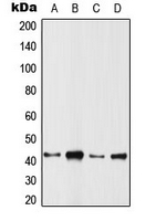ARFIP1 Antibody - Western blot analysis of ARFIP1 expression in HeLa (A); SP2/0 (B); PC12 (C); rat muscle (D) whole cell lysates.