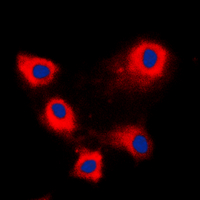 ARFIP1 Antibody - Immunofluorescent analysis of ARFIP1 staining in HeLa cells. Formalin-fixed cells were permeabilized with 0.1% Triton X-100 in TBS for 5-10 minutes and blocked with 3% BSA-PBS for 30 minutes at room temperature. Cells were probed with the primary antibody in 3% BSA-PBS and incubated overnight at 4 C in a humidified chamber. Cells were washed with PBST and incubated with a DyLight 594-conjugated secondary antibody (red) in PBS at room temperature in the dark. DAPI was used to stain the cell nuclei (blue).