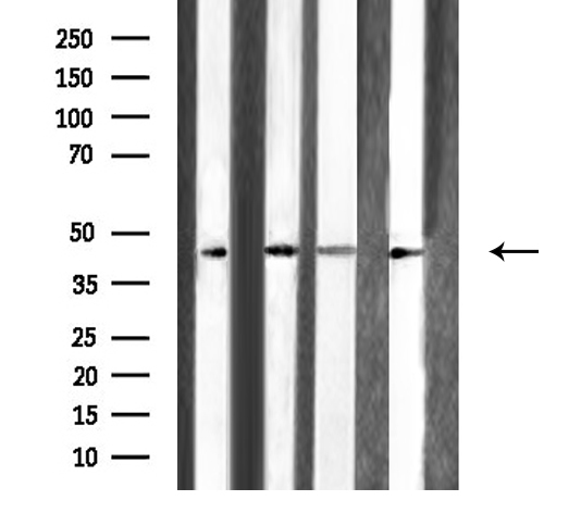 ARFIP1 Antibody - Western blot analysis of ARFIP1 expression in various lysates