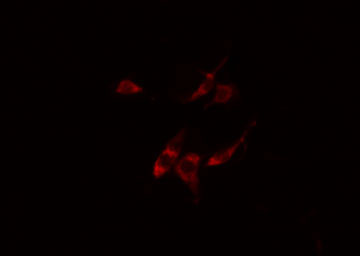 ARFIP1 Antibody - Staining HeLa cells by IF/ICC. The samples were fixed with PFA and permeabilized in 0.1% Triton X-100, then blocked in 10% serum for 45 min at 25°C. The primary antibody was diluted at 1:200 and incubated with the sample for 1 hour at 37°C. An Alexa Fluor 594 conjugated goat anti-rabbit IgG (H+L) antibody, diluted at 1/600, was used as secondary antibody.