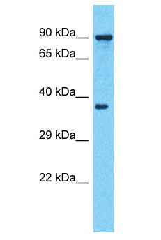ARFIP1 Antibody - ARFIP1 antibody Western Blot of MDA-MB-435s. Antibody dilution: 1 ug/ml.  This image was taken for the unconjugated form of this product. Other forms have not been tested.