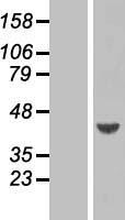 ARFIP1 Protein - Western validation with an anti-DDK antibody * L: Control HEK293 lysate R: Over-expression lysate