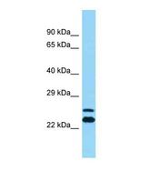 ARFIP2 / Arfaptin 2 Antibody - Western blot of Human THP-1. ARFIP2 antibody dilution 1.0 ug/ml.  This image was taken for the unconjugated form of this product. Other forms have not been tested.