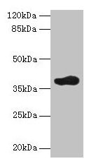 ARFIP2 / Arfaptin 2 Antibody - Western blot All lanes: ARFIP2 antibody at 2µg/ml + Mouse brain tissue Secondary Goat polyclonal to rabbit IgG at 1/10000 dilution Predicted band size: 38, 30, 34 kDa Observed band size: 38 kDa