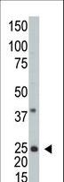 ARFL3 / ARL3 Antibody - Western blot of anti-hARL3 -M1 antibody in A2058 cell line lysate (35 ug/lane). hARL3 -M1(arrow) was detected using the purified antibody.