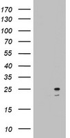 ARFL3 / ARL3 Antibody - HEK293T cells were transfected with the pCMV6-ENTRY control (Left lane) or pCMV6-ENTRY ARL3 (Right lane) cDNA for 48 hrs and lysed. Equivalent amounts of cell lysates (5 ug per lane) were separated by SDS-PAGE and immunoblotted with anti-ARL3.