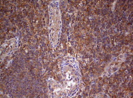 ARFL3 / ARL3 Antibody - IHC of paraffin-embedded Human tonsil using anti-ARL3 mouse monoclonal antibody. (Heat-induced epitope retrieval by 10mM citric buffer, pH6.0, 120°C for 3min).