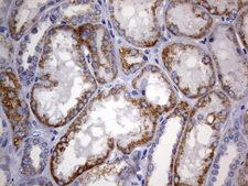 ARFL3 / ARL3 Antibody - IHC of paraffin-embedded Human Kidney tissue using anti-ARL3 mouse monoclonal antibody. (Heat-induced epitope retrieval by 10mM citric buffer, pH6.0, 120°C for 3min).