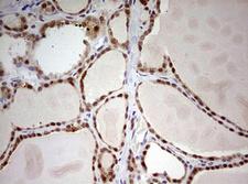ARFL3 / ARL3 Antibody - IHC of paraffin-embedded Human thyroid tissue using anti-ARL3 mouse monoclonal antibody. (Heat-induced epitope retrieval by 10mM citric buffer, pH6.0, 120°C for 3min).
