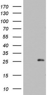 ARFL3 / ARL3 Antibody - HEK293T cells were transfected with the pCMV6-ENTRY control (Left lane) or pCMV6-ENTRY ARL3 (Right lane) cDNA for 48 hrs and lysed. Equivalent amounts of cell lysates (5 ug per lane) were separated by SDS-PAGE and immunoblotted with anti-ARL3.