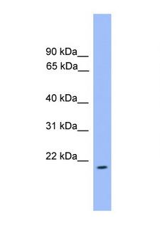 ARFL3 / ARL3 Antibody - ARL3 antibody Western blot of MCF7 Cell lysate. Antibody concentration 1 ug/ml.  This image was taken for the unconjugated form of this product. Other forms have not been tested.