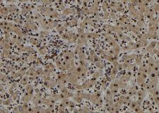 ARFL3 / ARL3 Antibody - 1:100 staining human liver tissue by IHC-P. The sample was formaldehyde fixed and a heat mediated antigen retrieval step in citrate buffer was performed. The sample was then blocked and incubated with the antibody for 1.5 hours at 22°C. An HRP conjugated goat anti-rabbit antibody was used as the secondary.