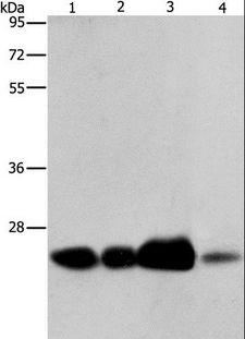 ARFRP1 Antibody - Western blot analysis of 293T cell and human fetal liver tissue, human cervical cancer and fetal muscle tissue, using ARFRP1 Polyclonal Antibody at dilution of 1:800.