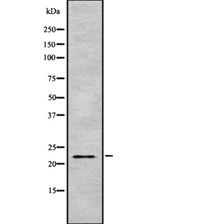 ARFRP1 Antibody - Western blot analysis of ARFRP1 using Jurkat whole lysates.