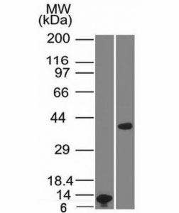 ARG1 / Arginase 1 Antibody - Western blot analysis of A) partial recombinant ARG1 protein and B) human liver lysate using Arginase 1 antibody (ARG1/1125).  This image was taken for the unmodified form of this product. Other forms have not been tested.