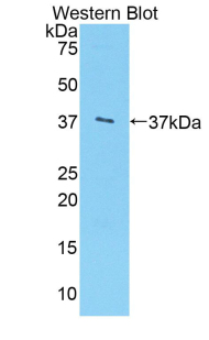ARG1 / Arginase 1 Antibody - Western blot of recombinant ARG1 / Arginase 1. This image was taken for the unconjugated form of this product. Other forms have not been tested.