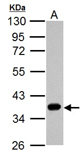 ARG1 / Arginase 1 Antibody - Arginase 1 antibody detects ARG1 protein by Western blot analysis. A. 30 ug HepG2 whole cell lysate/extract. 10 % SDS-PAGE. Arginase 1 antibody dilution:1:1000
