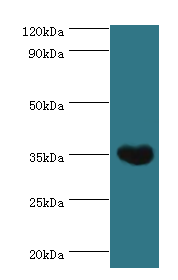 ARG1 / Arginase 1 Antibody - Western blot. All lanes: Arginase-1 antibody at 3 ug/ml+mouse liver tissue. Secondary antibody: Goat polyclonal to rabbit at 1:10000 dilution. Predicted band size: 35 kDa. Observed band size: 35 kDa Immunohistochemistry.