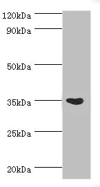 ARG1 / Arginase 1 Antibody - Western blot All lanes: Arginase-1 antibody at 3µg/ml + Mouse liver tissue Secondary Goat polyclonal to rabbit IgG at 1/10000 dilution Predicted band size: 35, 36, 26 kDa Observed band size: 35 kDa