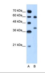 ARG1 / Arginase 1 Antibody - Lane A: Marker. Lane B: Jurkat cell lysate. Antibody concentration: 5.0 ug/ml. Gel concentration: 12%.  This image was taken for the unconjugated form of this product. Other forms have not been tested.