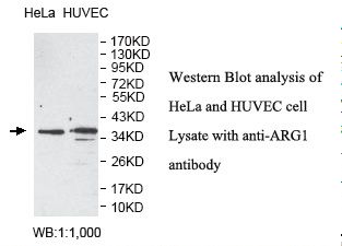 ARG1 / Arginase 1 Antibody