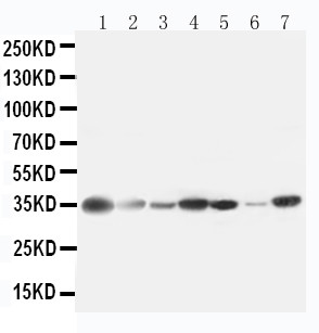 ARG1 / Arginase 1 Antibody - WB of ARG1 / Arginase 1 antibody. All lanes: Anti-ARG1 at 0.5ug/ml. Lane 1: Rat Liver Tissue Lysate at 40ug. Lane 2: Rat Kidney Tissue Lysate at 40ug. Lane 3: A549 Whole Cell Lysate at 40ug. Lane 4: RAJI Whole Cell Lysate at 40ug. Lane 5: 293T Whole Cell Lysate at 40ug. Lane 6: HELA Whole Cell Lysate at 40ug. Lane 7: 22RV1 Whole Cell Lysate at 40ug. Predicted bind size: 35KD. Observed bind size: 35KD.