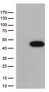 ARG1 / Arginase 1 Antibody - HEK293T cells were transfected with the pCMV6-ENTRY control. (Left lane) or pCMV6-ENTRY ARG1. (Right lane) cDNA for 48 hrs and lysed. Equivalent amounts of cell lysates. (5 ug per lane) were separated by SDS-PAGE and immunoblotted with anti-ARG1. (1:500)