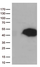 ARG1 / Arginase 1 Antibody - HEK293T cells were transfected with the pCMV6-ENTRY control. (Left lane) or pCMV6-ENTRY ARG1. (Right lane) cDNA for 48 hrs and lysed. Equivalent amounts of cell lysates. (5 ug per lane) were separated by SDS-PAGE and immunoblotted with anti-ARG1. (1:500)