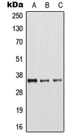 ARG1 / Arginase 1 Antibody - Western blot analysis of Arginase 1 expression in MCF7 (A); mouse liver (B); rat kidney (C) whole cell lysates.