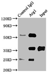 ARG1 / Arginase 1 Antibody - Immunoprecipitating Arg1 in Rat liver tissue Lane 1: Rabbit control IgG instead of Arg1 Antibody in Rat liver tissue.For western blotting, a HRP-conjugated Protein G antibody was used as the secondary antibody (1/2000) Lane 2: Arg1 Antibody (8µg) + Rat liver tissue (500µg) Lane 3: Rat liver tissue (10µg)