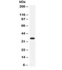 ARG1 / Arginase 1 Antibody